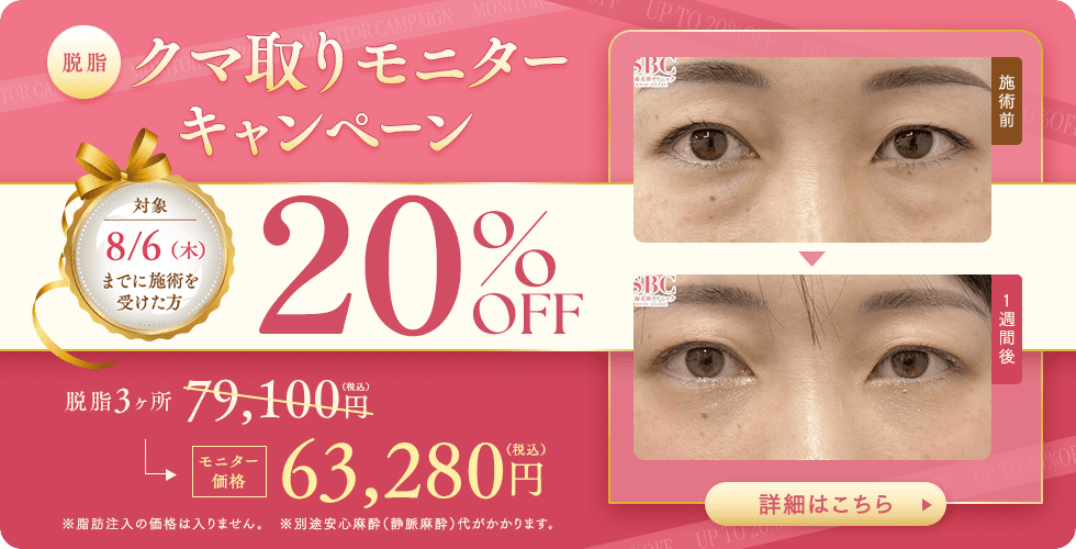 目の下の切らないクマ取り・たるみ（ふくらみ）取り キャンペーン