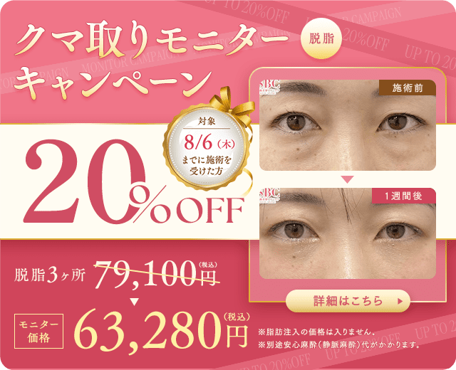 目の下の切らないクマ取り・たるみ（ふくらみ）取り キャンペーン