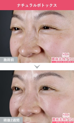 症例写真3