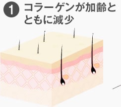 コラーゲンが加速とともに減少