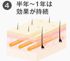 半年~1年は効果が持続