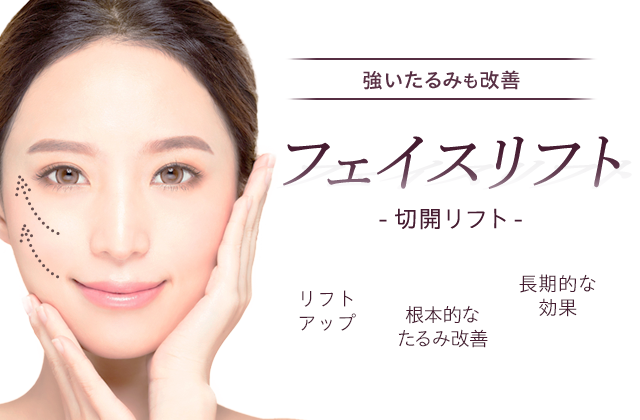 強いたるみも改善フェイスリフト（切開リフト）