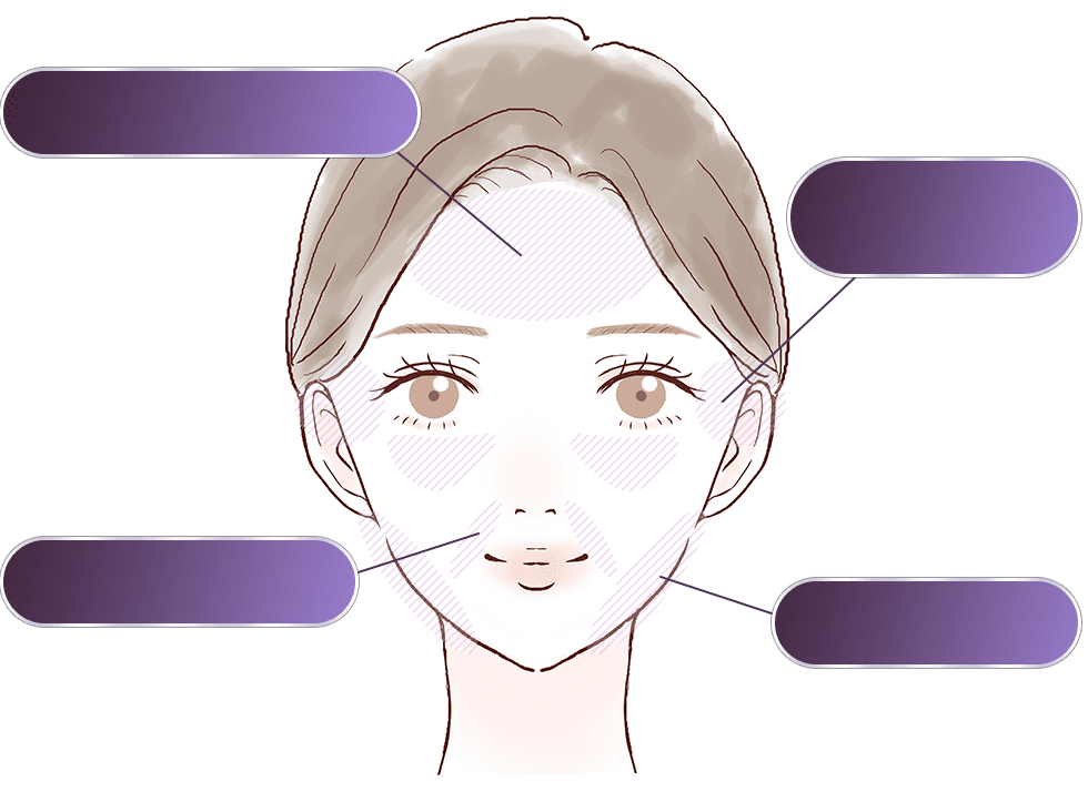 顔のお悩み部位を示すイラスト
