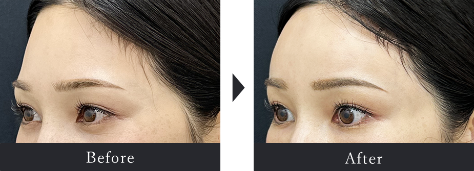 Before After