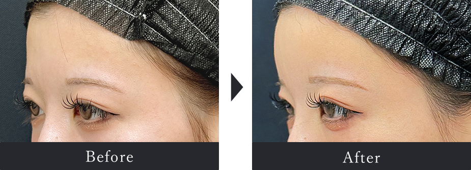 Before After