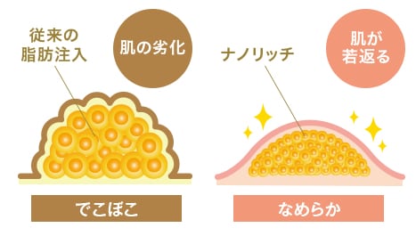 自然な仕上がり