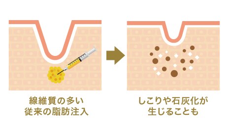 安全性が高い