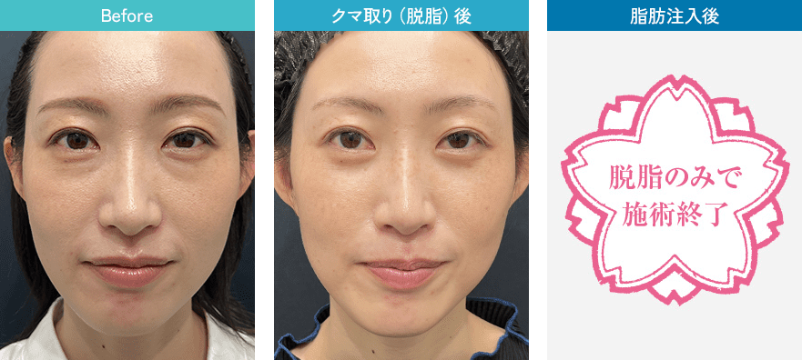 症例写真1