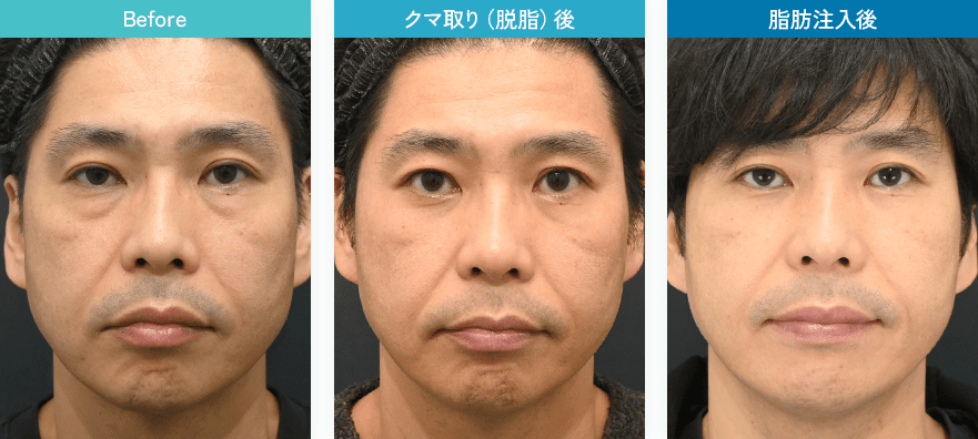 症例写真2