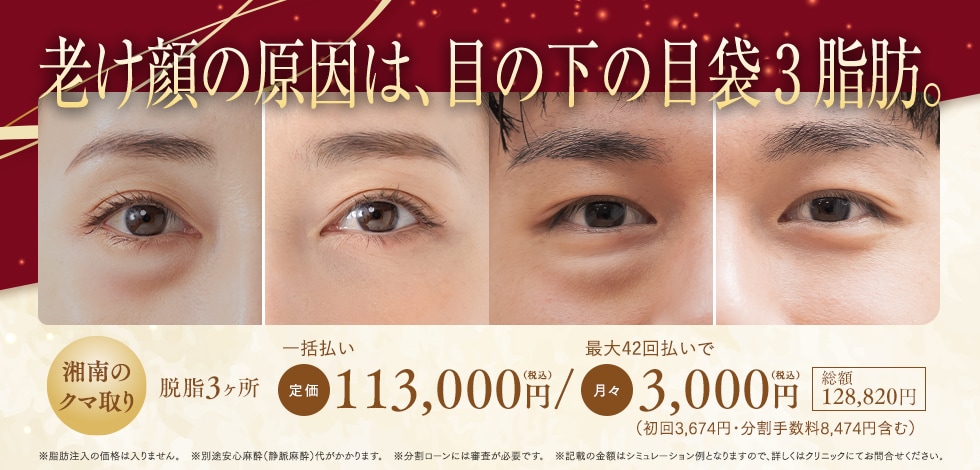 目の下の切らないクマたるみ取り