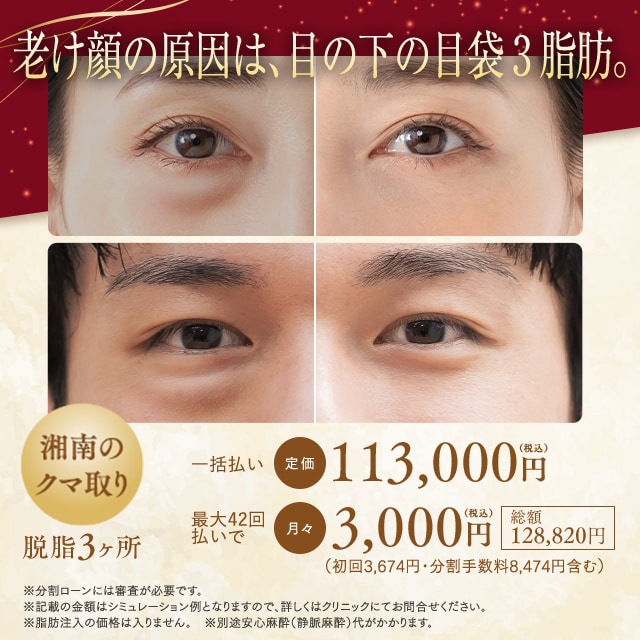 目の下の切らないクマたるみ取り