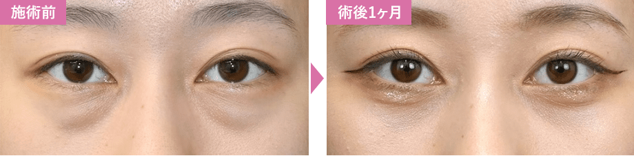 症例写真