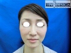 症例写真