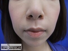 症例写真