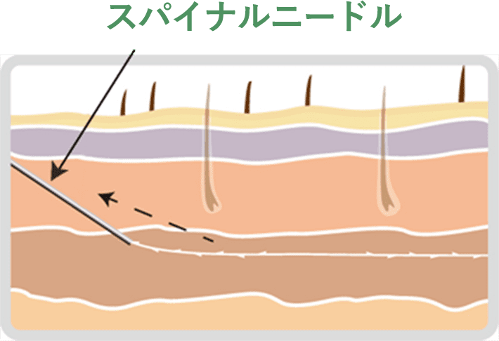STEP03