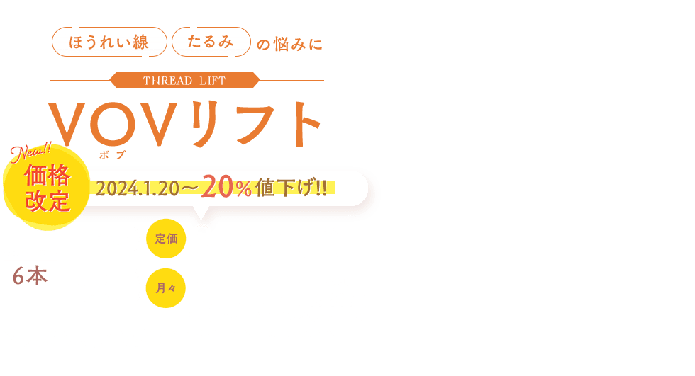 SBC VOVリフト