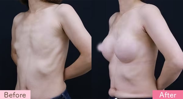 Motiva エルゴノミックス2の症例写真
