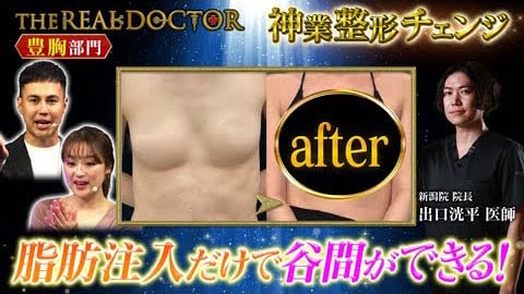 【脂肪注入豊胸】多層への脂肪注入で驚きのボリュームを作り出す新潟の神業ドクター