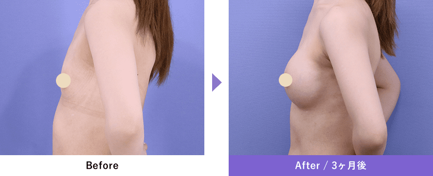 Before After / 3ヶ月後