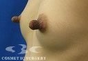 症例写真