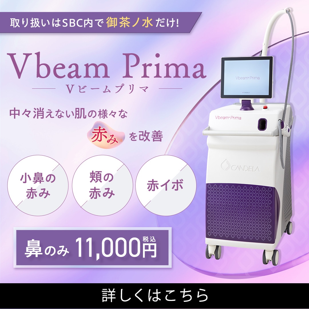 Ｖビーム