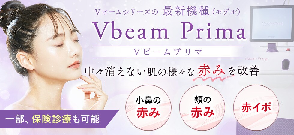 Vbeam prima（Vビームプリマ）