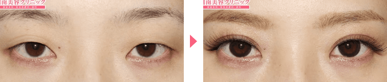 鴨田医師症例写真n285462