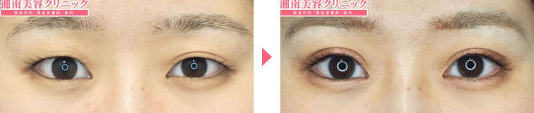 岩間医師症例写真n247701