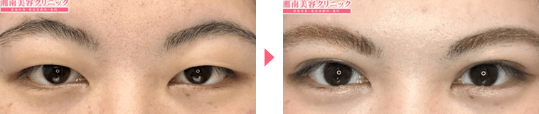 症例写真n248599