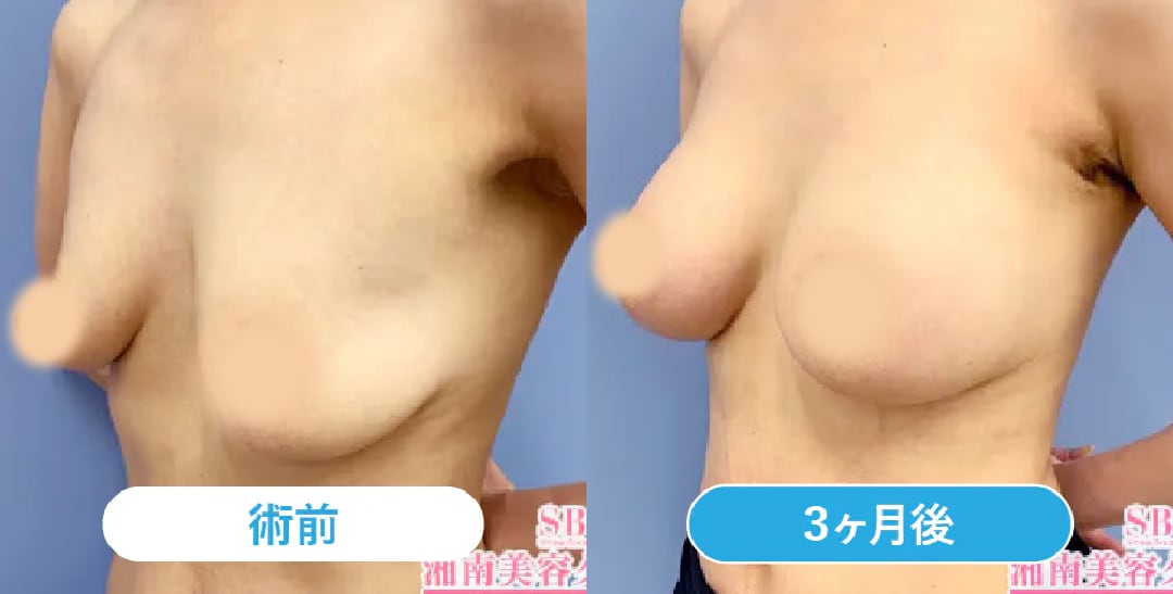 ベスト症例写真
