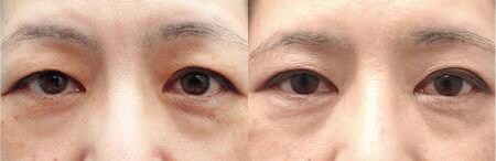 ベスト症例写真