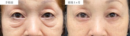 ベスト症例写真