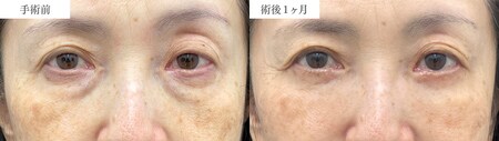 ベスト症例写真