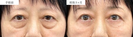 ベスト症例写真