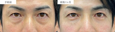 ベスト症例写真