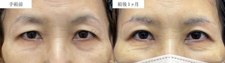 ベスト症例写真