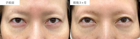 ベスト症例写真