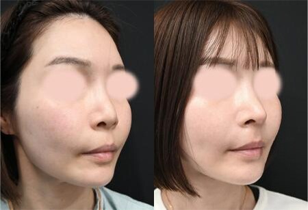 ベスト症例写真