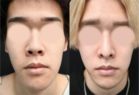 ベスト症例写真