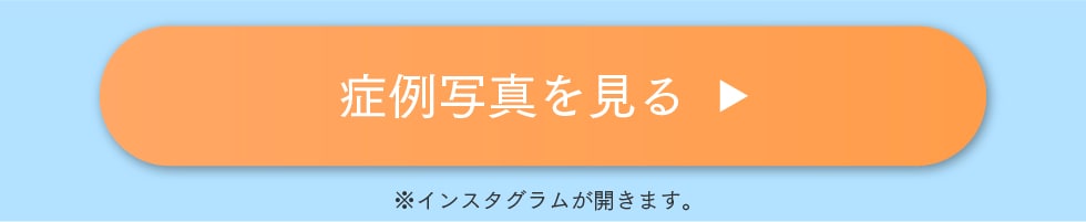 症例写真