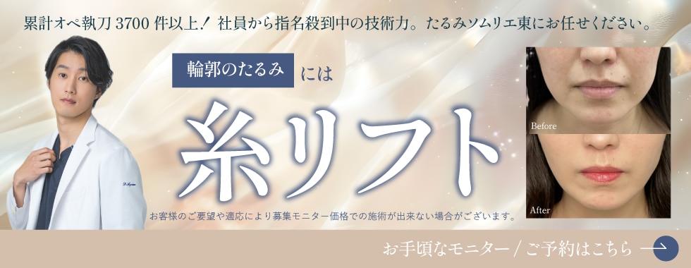 糸リフト
