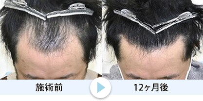 症例写真1