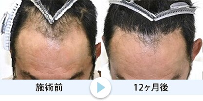 症例写真1