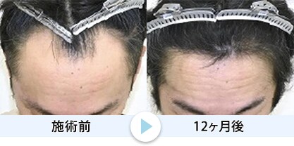 症例写真1