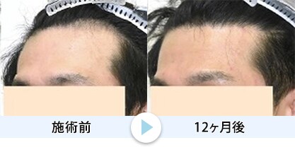 症例写真1