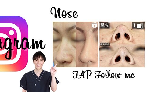 Instagram 鼻