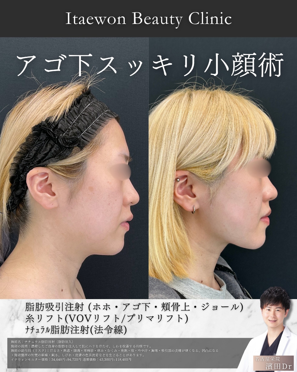 症例
