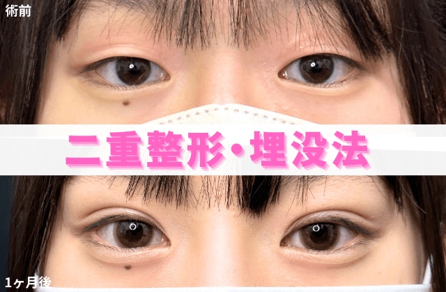 二重症例