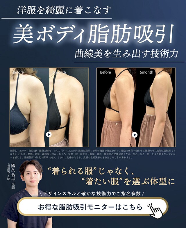 脂肪吸引モニター募集