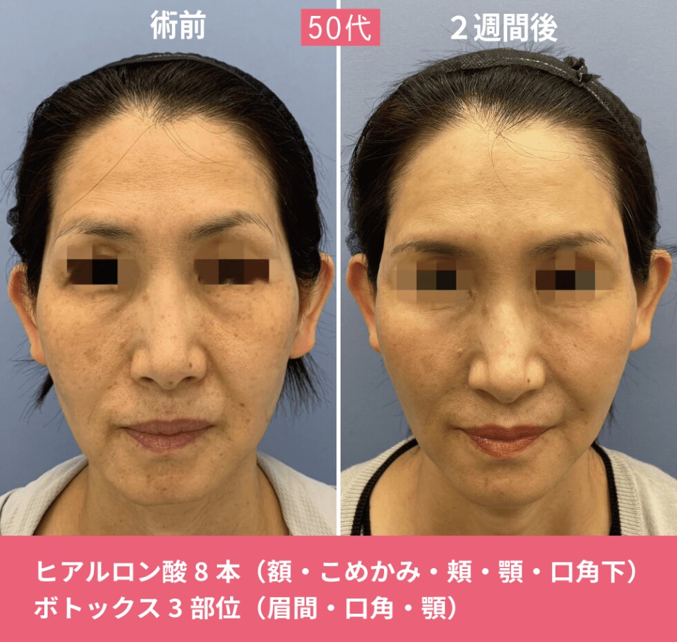 症例